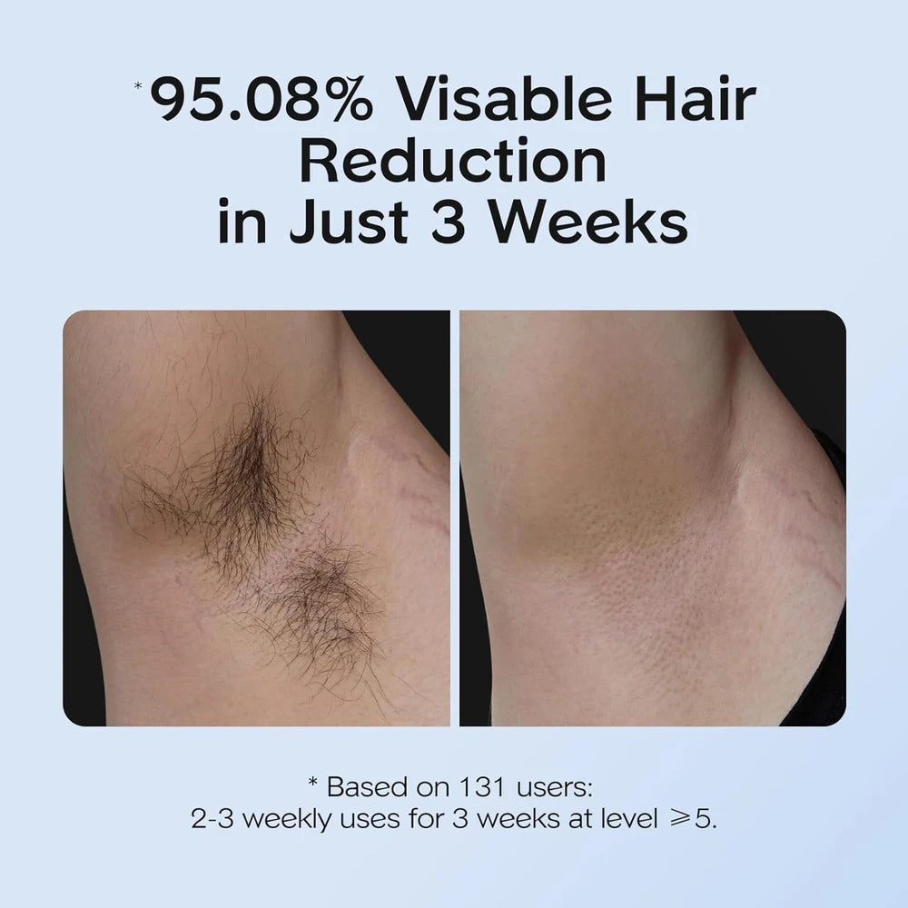 INNZA IPL Hair Removal with Ice Cooling Care Function for Women and men - White