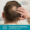Minoxidil for Men Foam 5%, Unscented 3 Month Supply, Supports Hair Regrowth (Pack of 3)