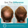Minoxidil for Men Foam 5%, Unscented 3 Month Supply, Supports Hair Regrowth (Pack of 3)