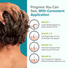 Minoxidil for Men Foam 5%, Unscented 3 Month Supply, Supports Hair Regrowth (Pack of 3)